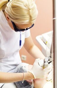 Доктор спроводи поступак фототермолизе