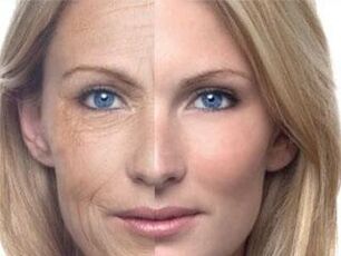 Пигментација коже